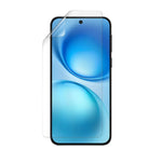 Hydrogel Screen Protector for Vivo X200 FE (Pack of 2) - V70