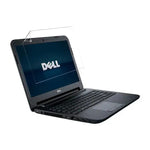 Hydrogel Screen Protector for Dell Inspiron 14 3421 (Pack of 2) - inches